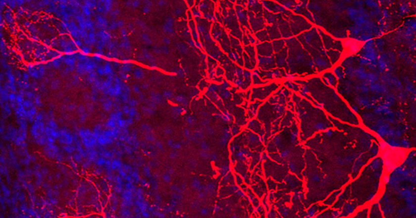 What changes in the brain when you become a parent?<br>(Laboratory for Comparative Connectomics)